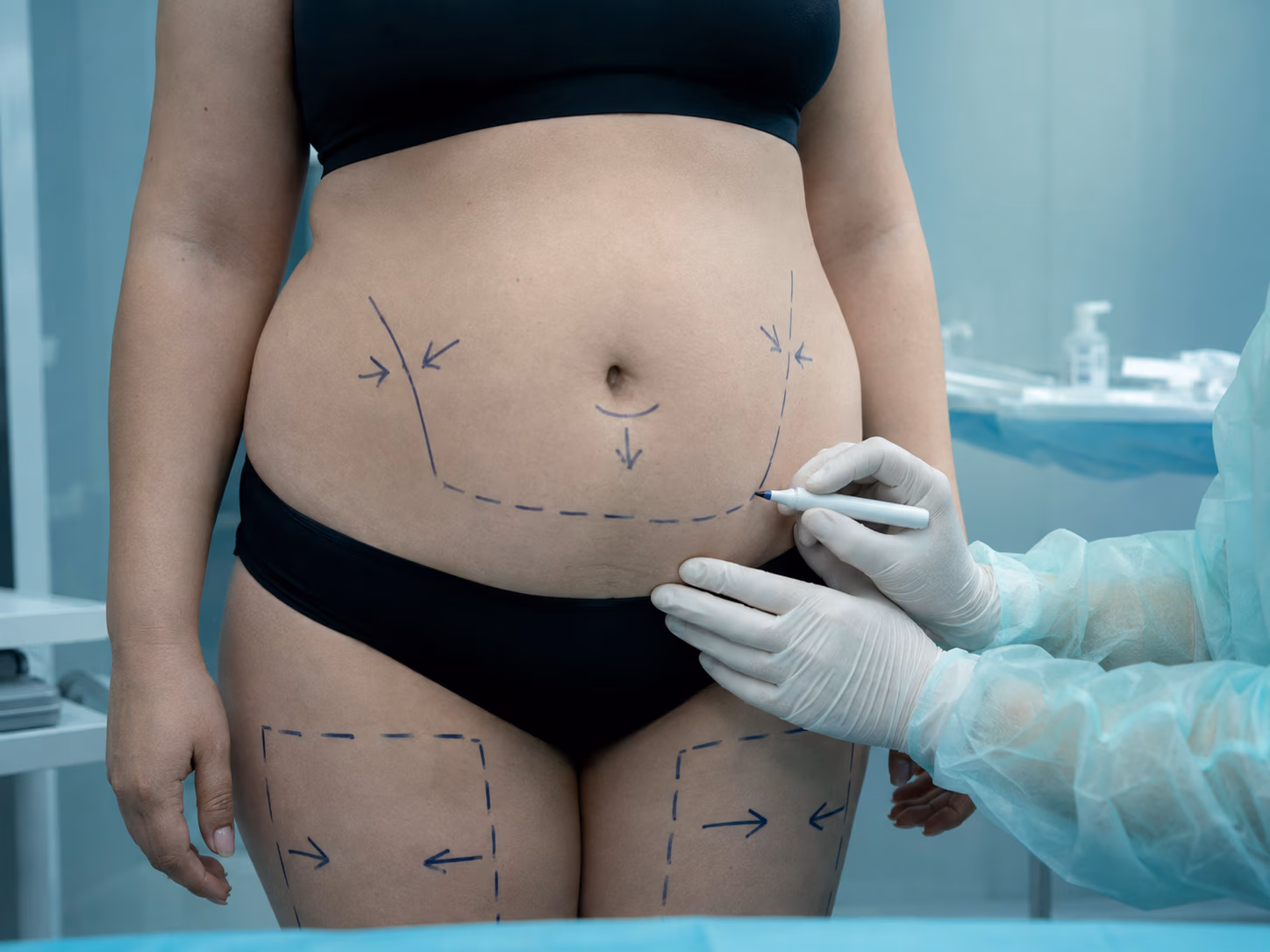 Body procedures