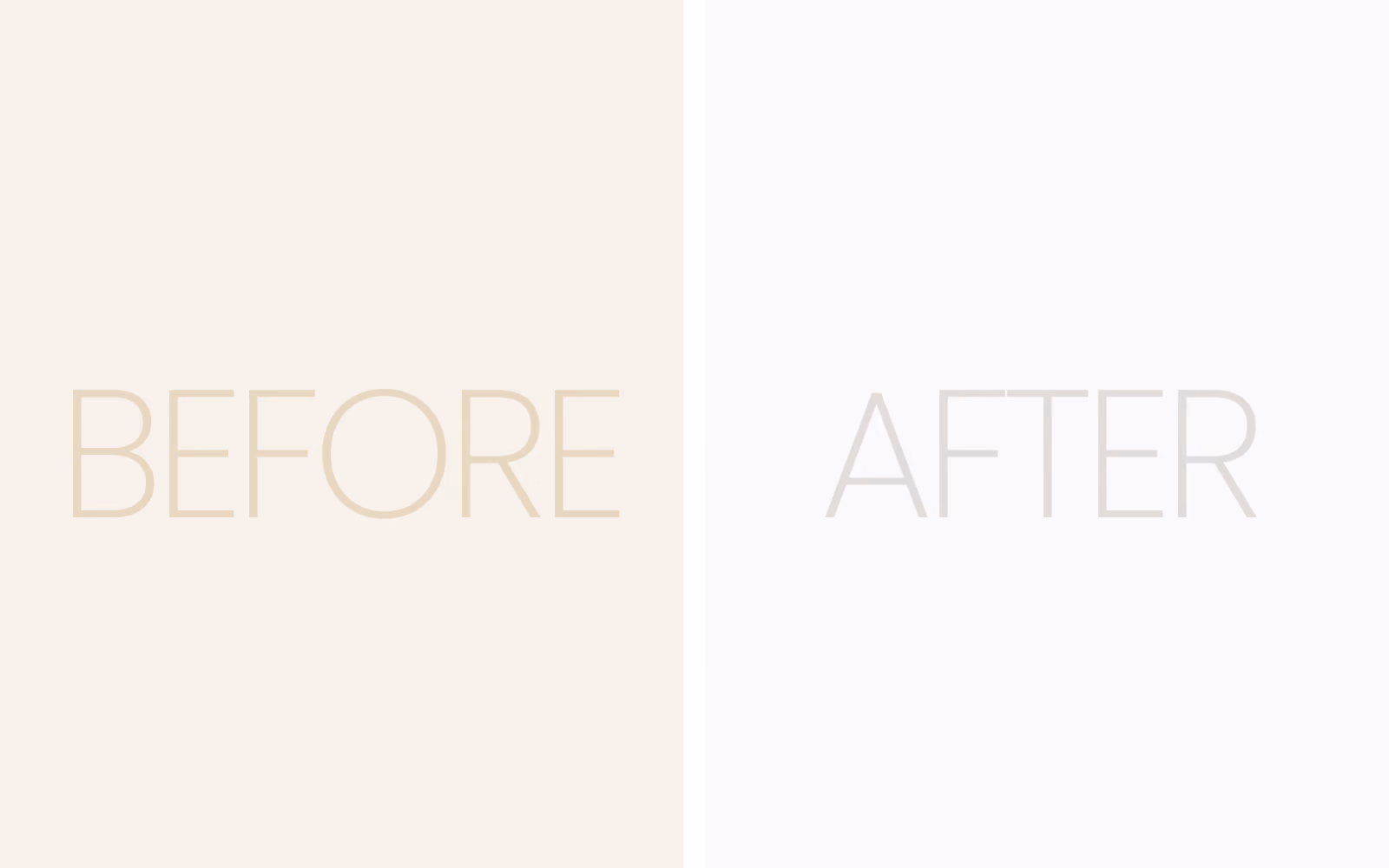 Deep Plane Facelift before and after result 1