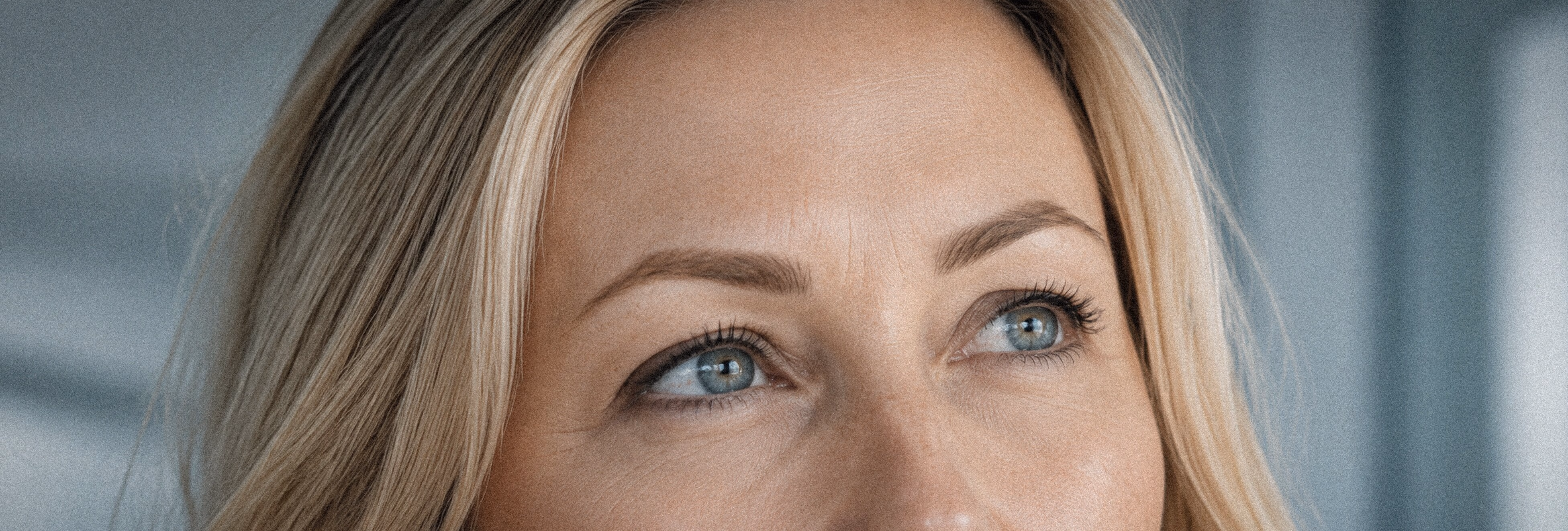 Frown Lines consultation and procedure planning